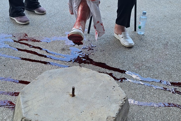Nakon ozljede žene na ulazu u pulski K centar oglasio se Konzum: "Žao nam je, lokacija je pregledana"