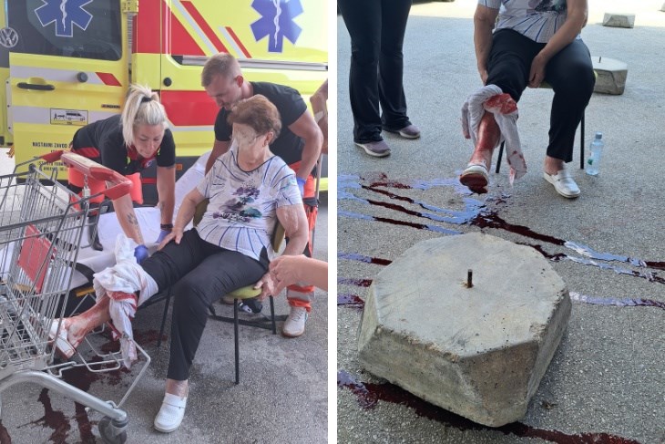 FOTO / Žena se ozlijedila na betonskoj prepreci u Šijani. "Ovo je stvarna opasnost za građane"