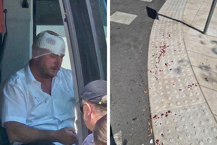 Pretučeni vozač autobusa: "Taksist laže, nikad ga prije nisam vidio"